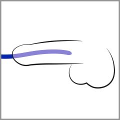   You2Toys - DILATOR - plavi silikonski dildo za širenje uretre (3 kom)