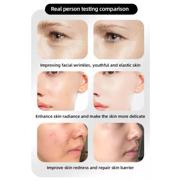 Photon Rejuvenation Njega lica LED maska